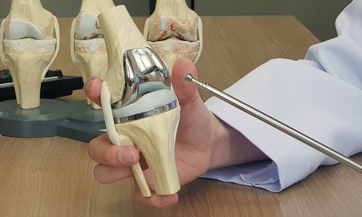 Knee Replacement Surgery